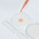Quy trình test tổng khuẩn