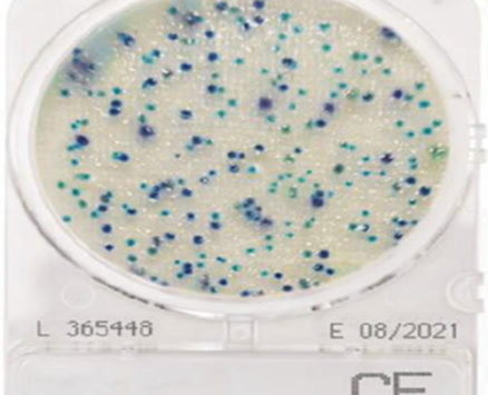 Đĩa Compact Dry kiểm tra Coliform | Coliform CF Nissui
