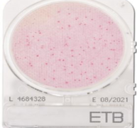 Đĩa Compact Dry Enterobacteriaceae | Enterobacteriaceae ETB Nissui
